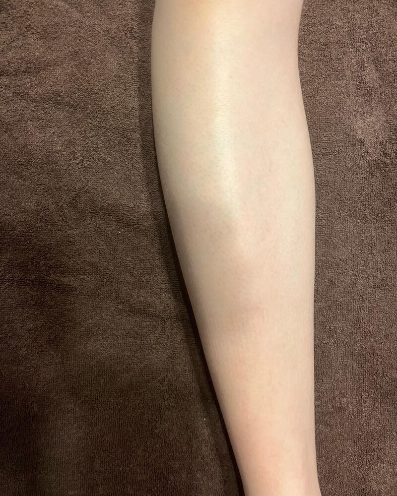 画像1404